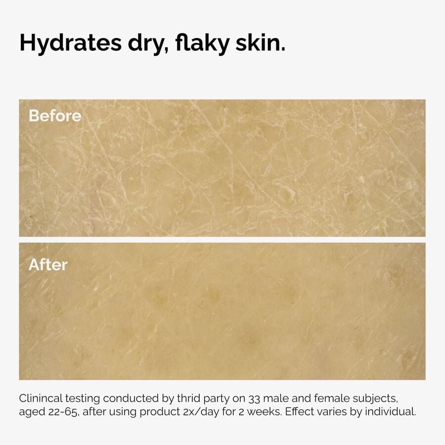 the-body-care-collection-o8 ord-natural-moisturizing-factors-inulin-body-before-after-graphic-02.jpg
