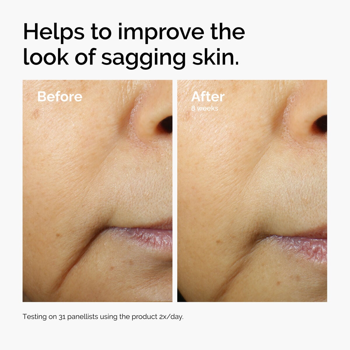 caffeine-3-escin-1-face-serum-q9 ord-caffeine-3pct-escin-1pct-face-serum-before-after-sagging.jpg