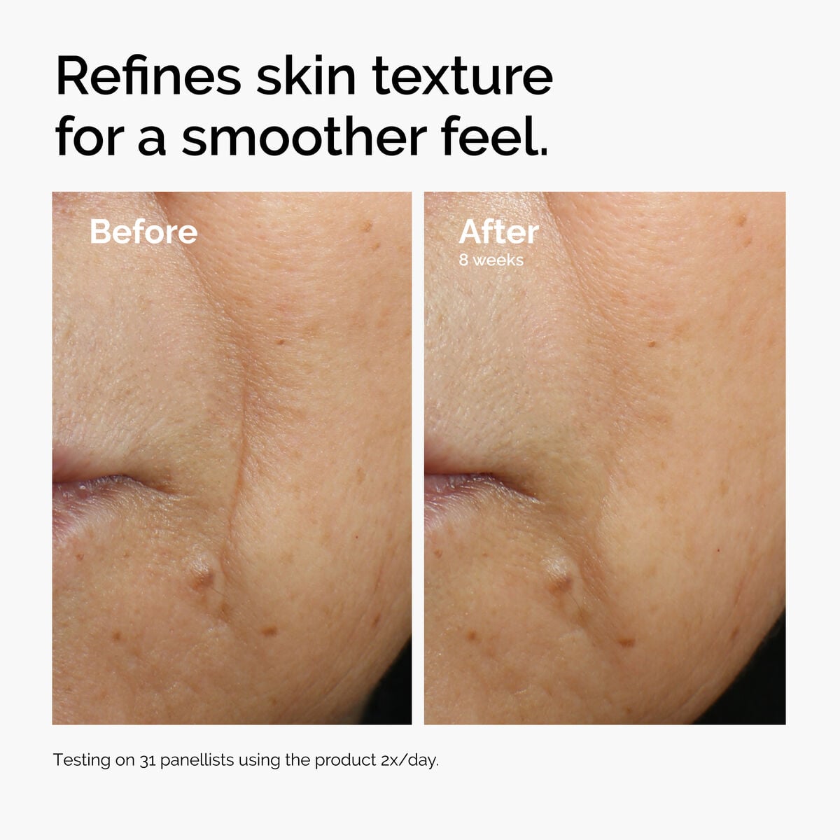 caffeine-3-escin-1-face-serum-q9 ord-caffeine-3pct-escin-1pct-face-serum-before-after-texture.jpg