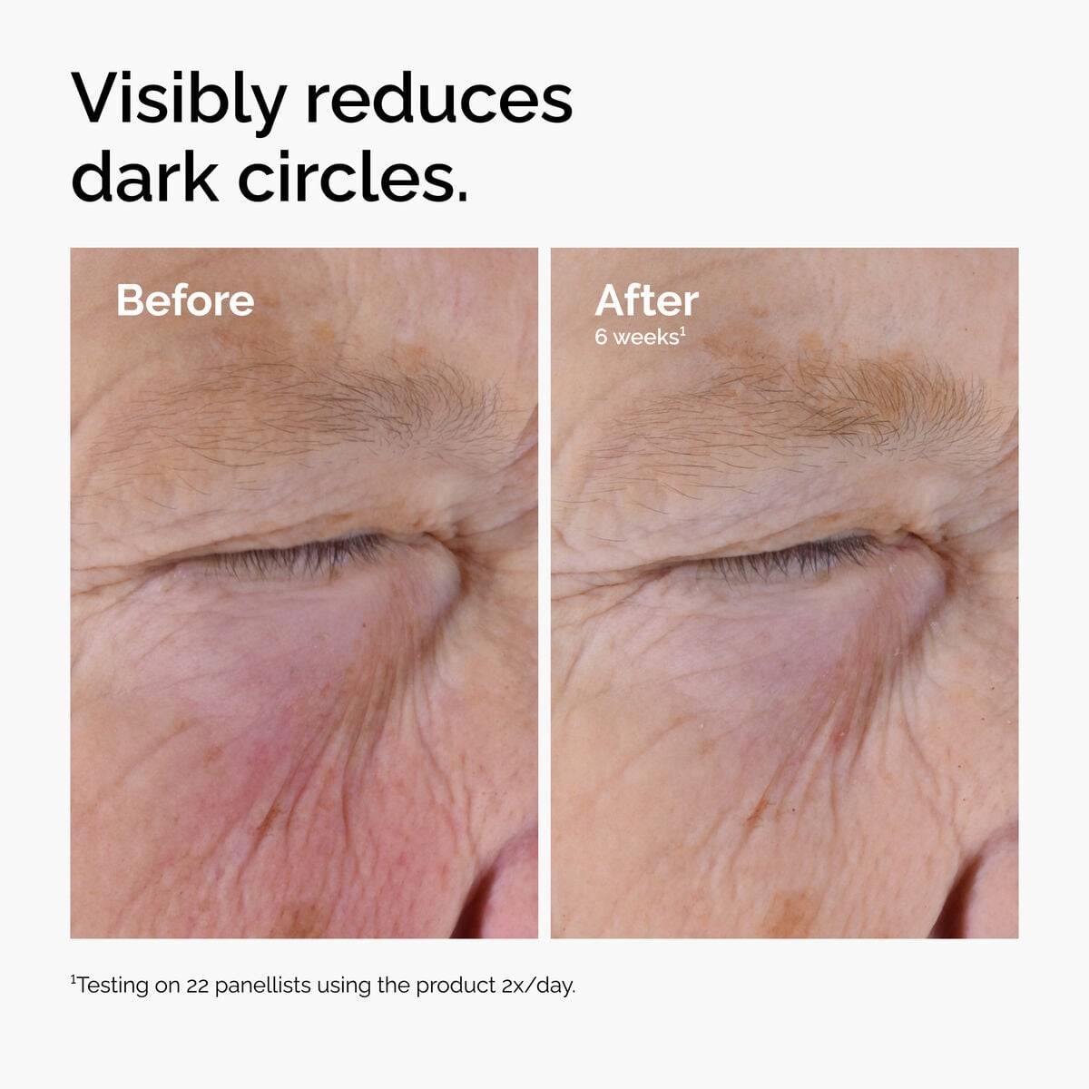 caffeine-solution-5-egcg-eye-serum-h3 ord-caffeine-solution-egcg-dark-circles-before-after.jpg