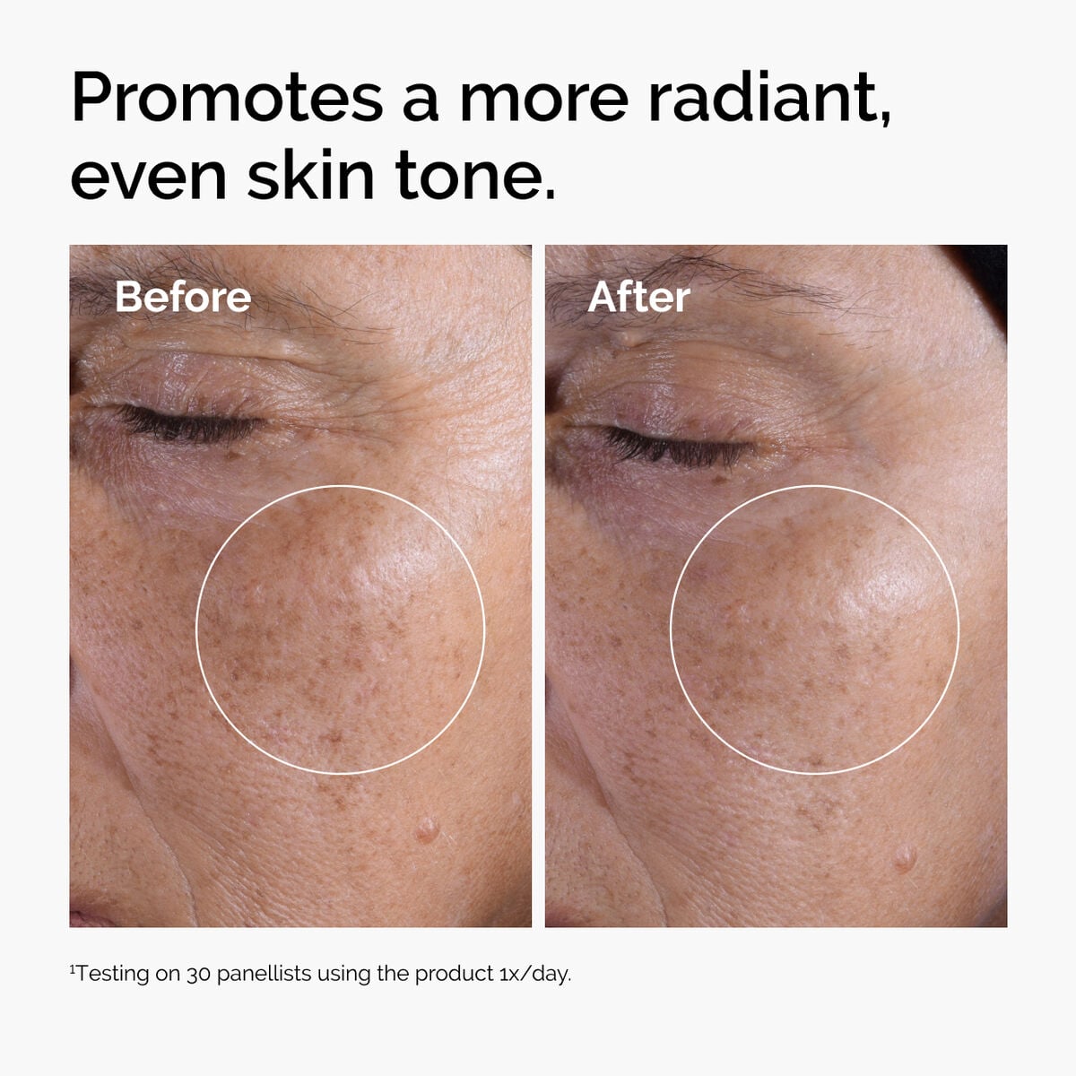 glycolic-acid-7-exfoliating-toner-u8 ord-glycolic-before-after-radiance.jpg