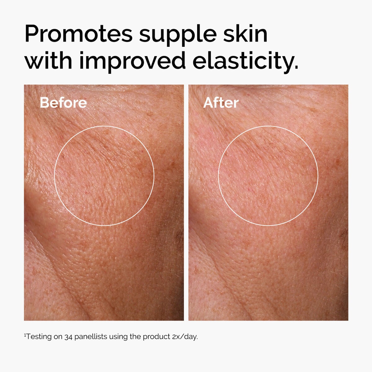 hyaluronic-acid-2-b5-with-ceramides-y6 ord-hyaluronic-acid-2pct-b5-hydrating-serum-before-after-elasticity.jpg