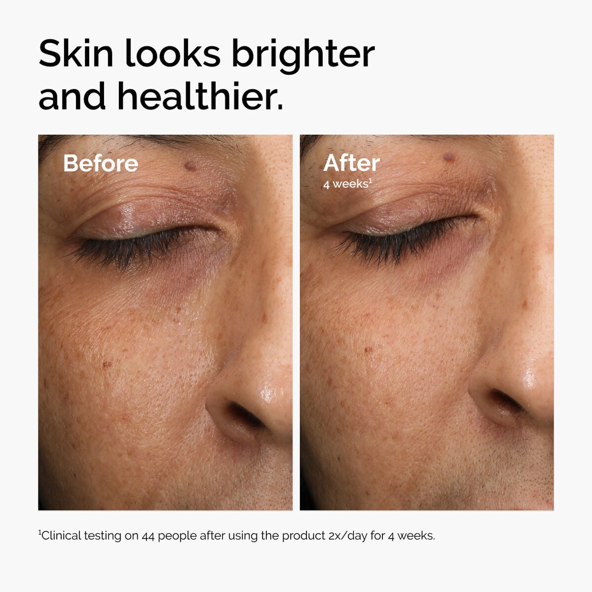 multi-antioxidant-radiance-serum-z6 ord-mars-before-after-healthy.jpg