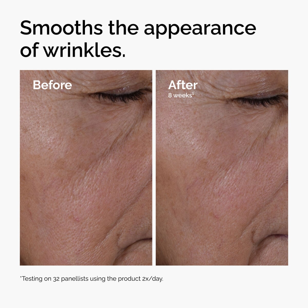 multi-peptide-ha-serum-j6 ord-multi-peptide-ha-serum-wrinkles-before-after.jpg