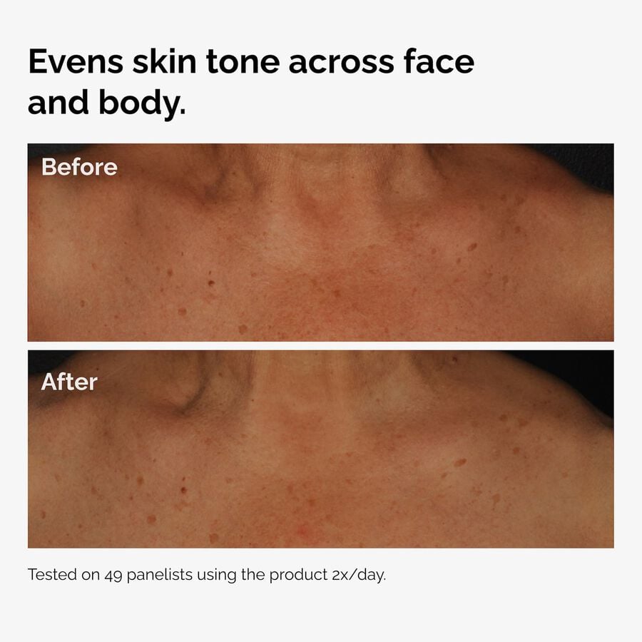 the-body-care-collection-o8 ord-niacinamide-face-body-serum-before-after-even-tone-graphic.jpg
