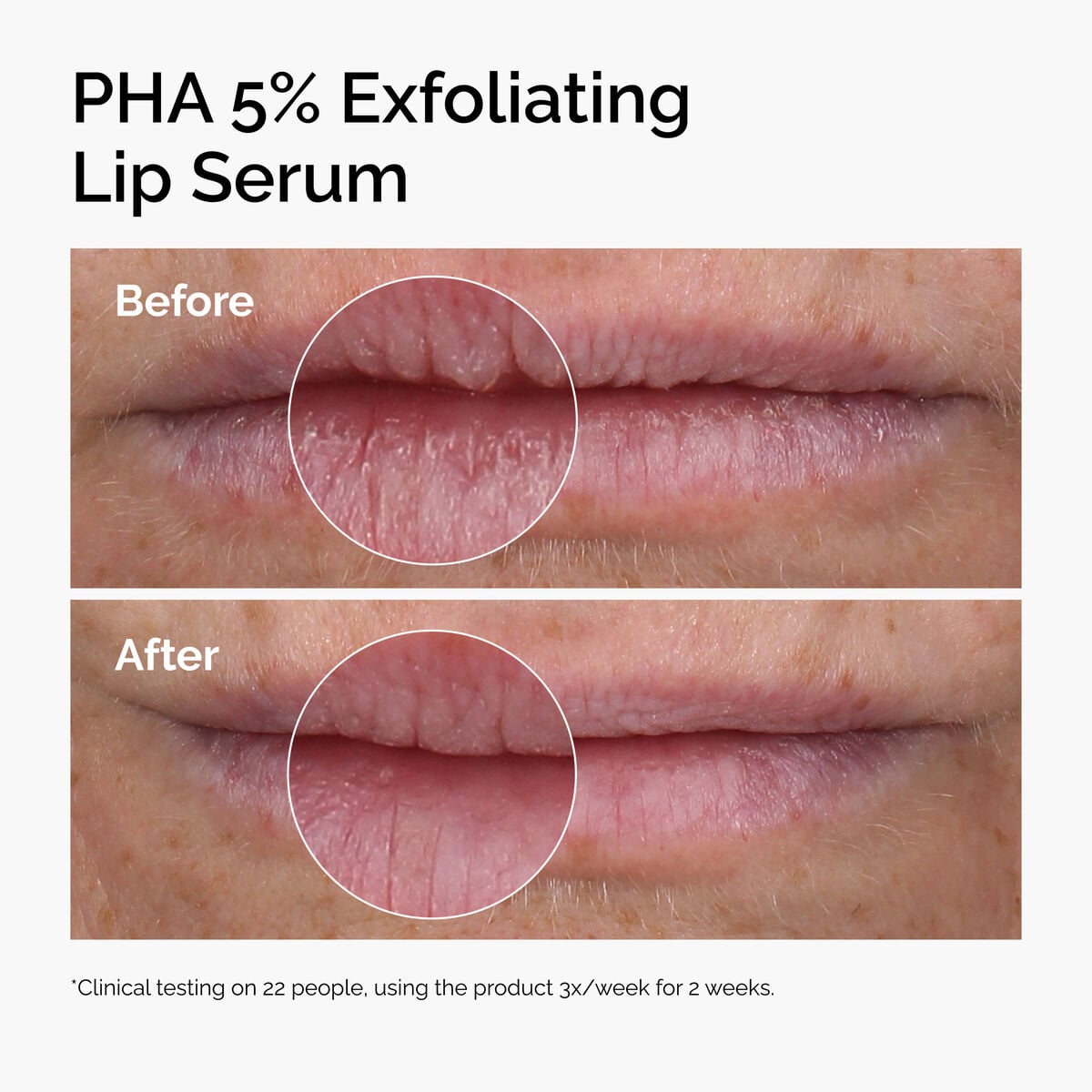 pha-5-exfoliating-lip-serum-w7 ord-pha-5pct-lip-exfoliating-serum-before-after.jpg