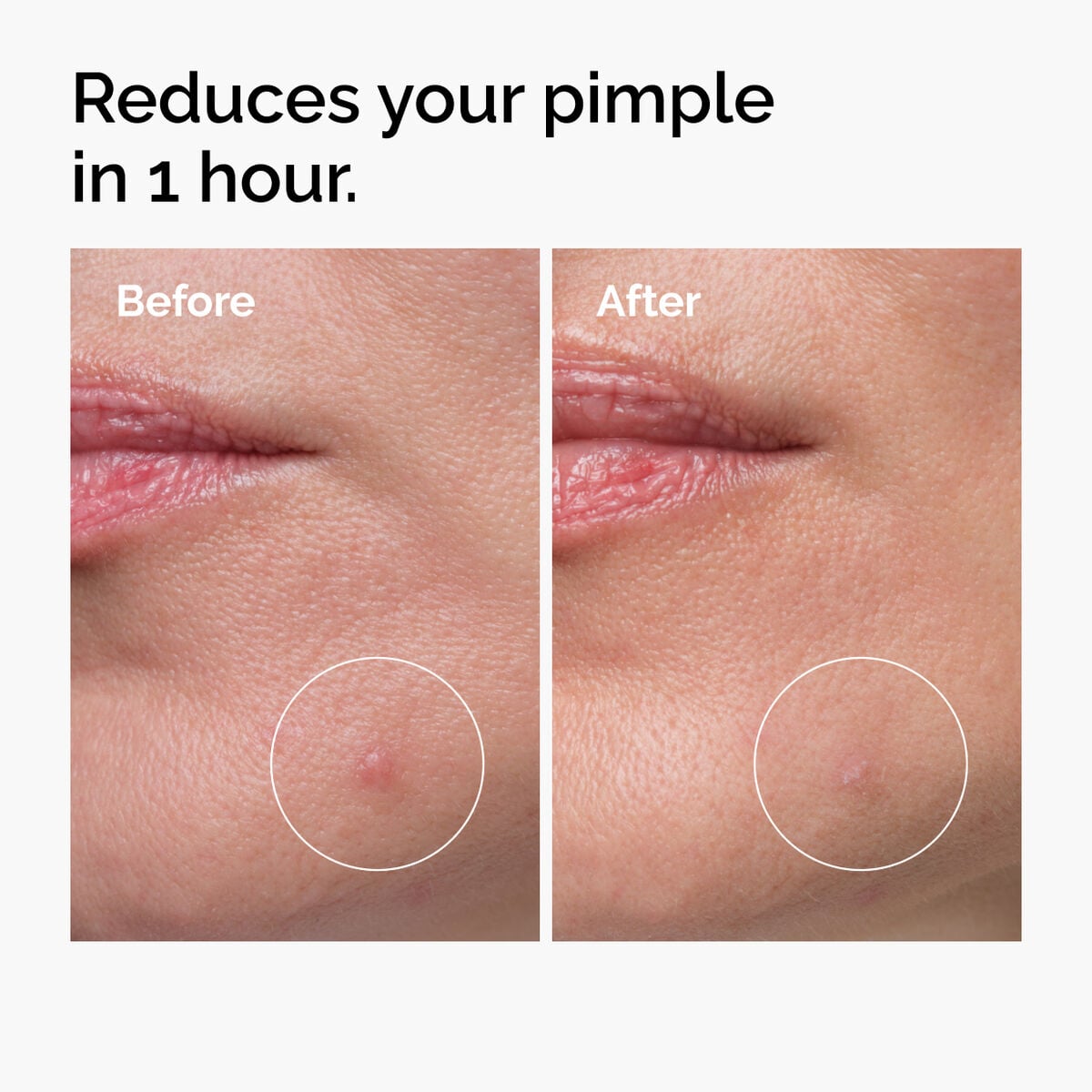 sulfur-10-powder-to-cream-concentrate-e5 ord-sulfur-10pct-powder-to-cream-concentrate-before-after-NA.jpg